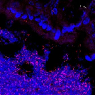 Schwefelwasserstoff produzierende Bakterien im Darm (in rot)-Huimin Ye 